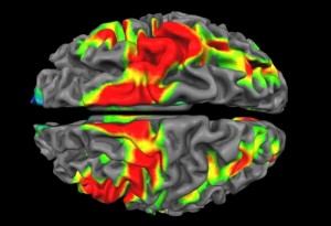 A new NSA program to drive-by neuroimage citizen's dreams is in its first stages of testing, says Snowden. A new NSA program to drive-by neuroimage citizen's dreams is in its first stages of testing, says Snowden.